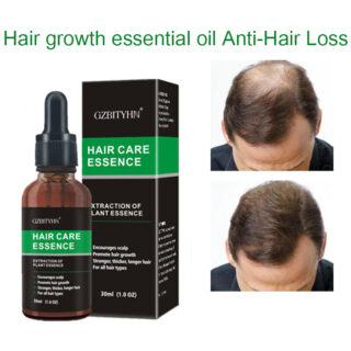 Hair Growth Oil - Premium Quality Global Selection | Official  Store - Premium Global Collection - Hair Growth Oil